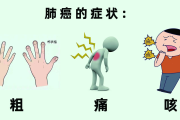 全国肿瘤防治宣传周丨早期肺癌可治愈 肺癌早筛很关键